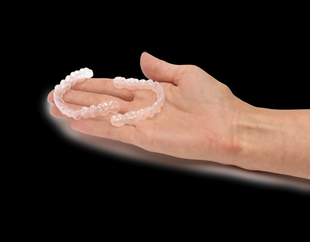 Clear Aligner Example