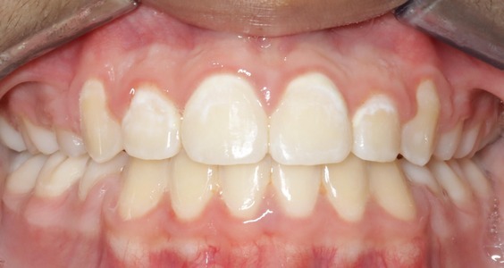 orthodontist irving tx