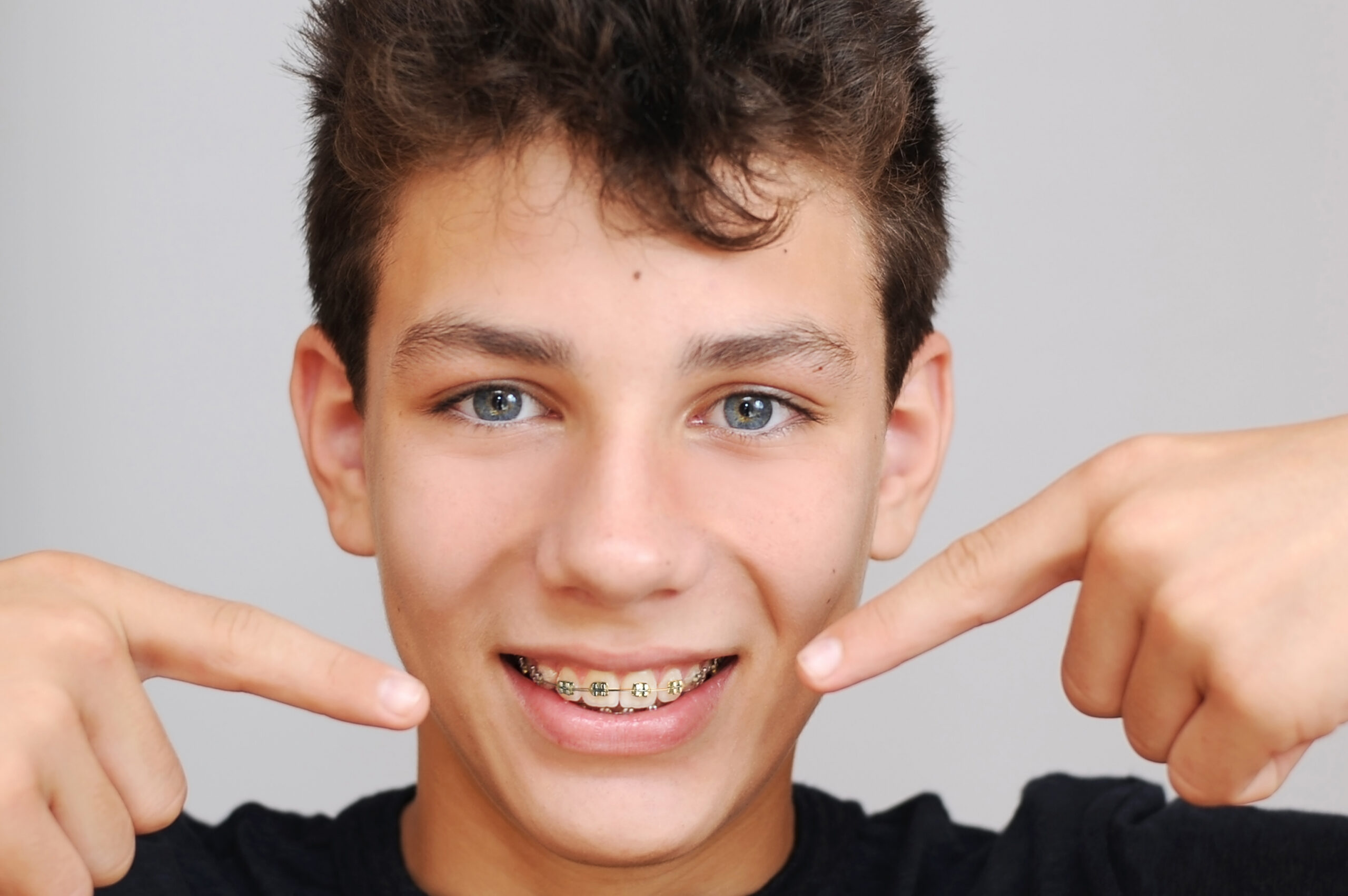 Braces in Irving, TX — What to Expect When You Choose Ward Orthodontics