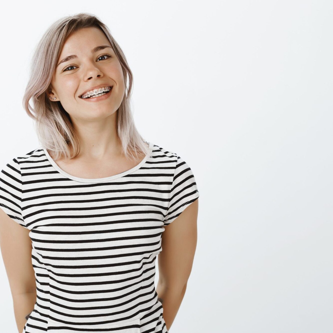 clear aligners irving texas
