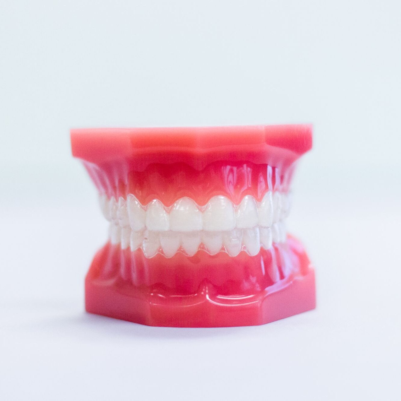 Clear Aligners